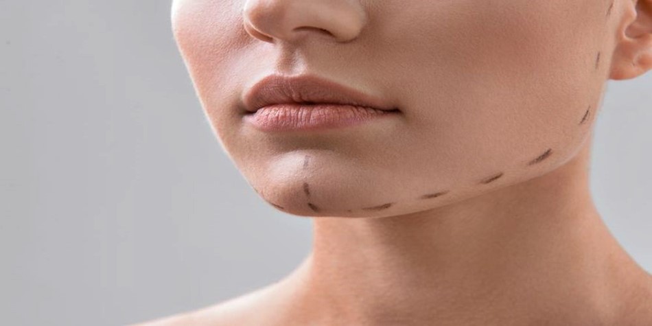 Under Chin Liposuction Techniques